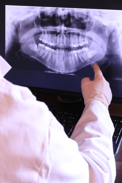 Best Emergency Treatment for Toothache in Mount Pleasant, IA